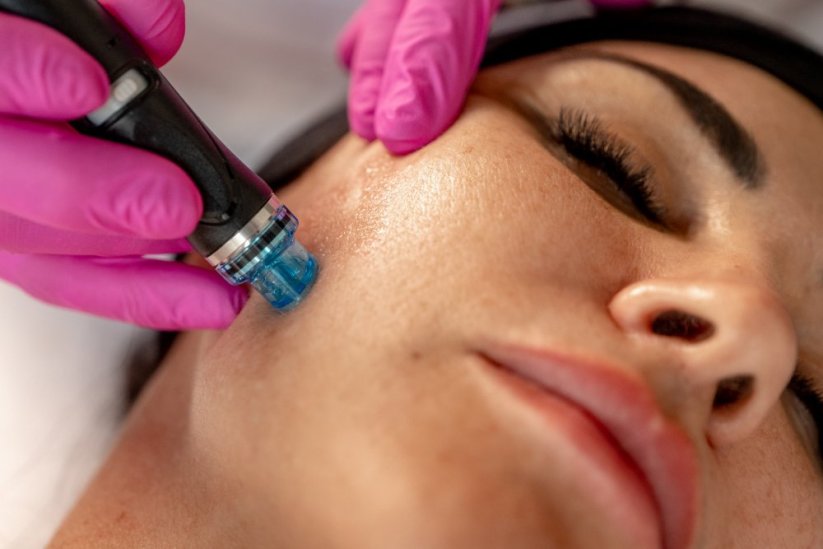 Zvýhodněný balíček 8 ošetření obličeje Hydrafacial Deluxe OPTIMAL B s 20% slevou